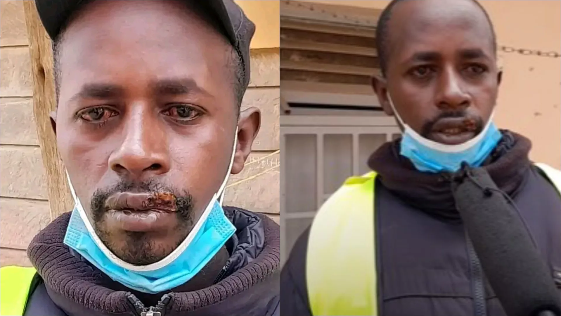 A male Bodaboda rider has narrated how his client bit his lip after he refused to have 'twa twa' with him. Antony Mwangi who hails from Roysambu is nursing injuries following the painful incidence that saw part of his upper lip off. While speaking to Paxson Tv, Antony Mwangi said that got a client on Friday evening. The client requested to be dropped at a place called Zebra in Zimmerman. On reaching the destination, the client said that he did not have any cash. The client instructed him to accompany him to the his apartment to collect his dues. Unaware of what was awaiting, the rider followed the client to his room which was on the third floor. At first, the client was very hospitable. He even requested Anthony to sit down for some refreshments. When Antony declined the offer, the client became very hostile. He immediately snatched the phone from Antony and ordered him to bend over for a twatwa session Efforts by Mwangi to resist the heinous act made the client more aggressive. He jumped on him in an attempted to kiss him and ended bitting off his upper lip. Mwangi screamed and cried for help prompting neighbors to run to the scene. They offered first aid before calling the police officer. Upon arrival at the scene, the police officers arrested the client and took him to Kasarani police station